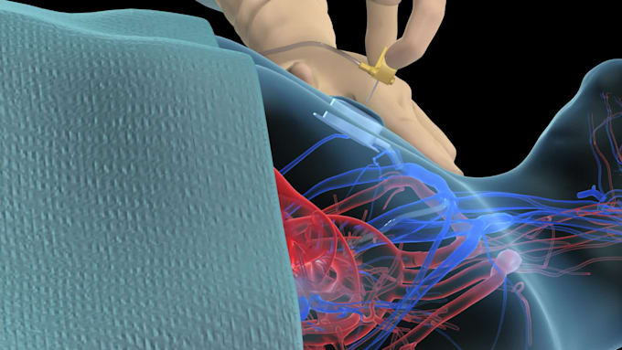 create 3d medical surgery animation and surgical procedure