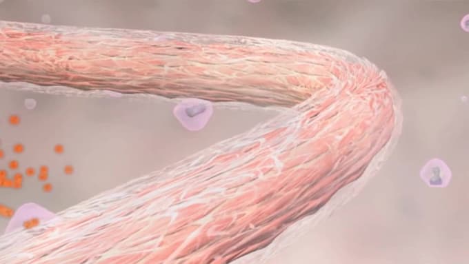 do 3d pathology or disease process, 3d medical animation, 3d medical explainer