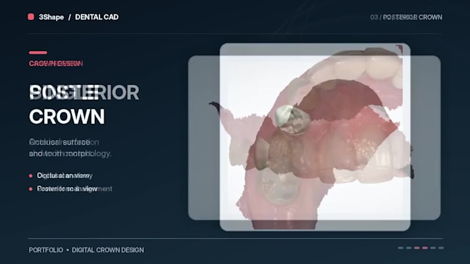 design anterior and posterior dental crowns using 3shape