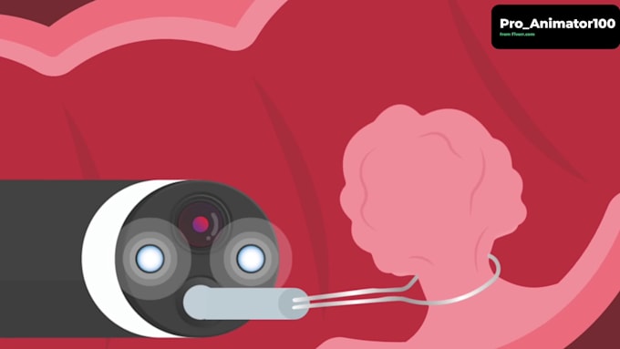 create medical or healthcare 2d animated explainer video