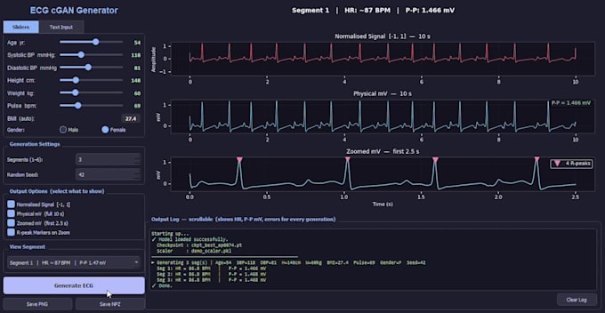 ecg signal processing, arrhythmia detection, and biomedical data analysis