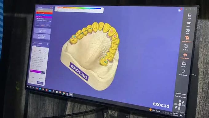 design zirconia bridge and crowns using exocad