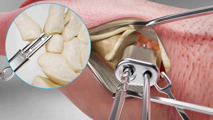 create 3d medical animation, healthcare explainer and scientific animation