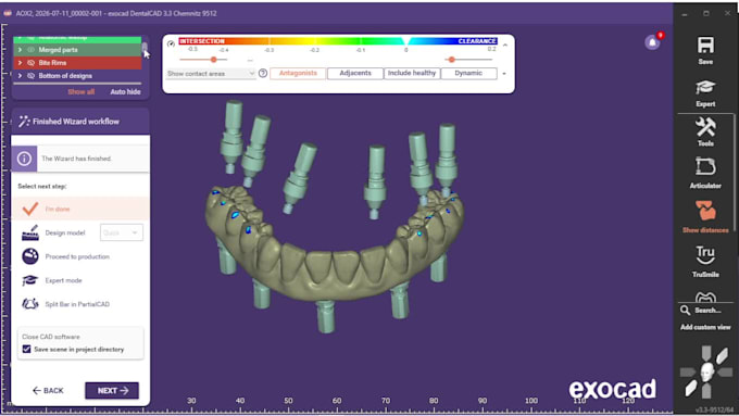 do professional all on x and full arch dental cases on exocad
