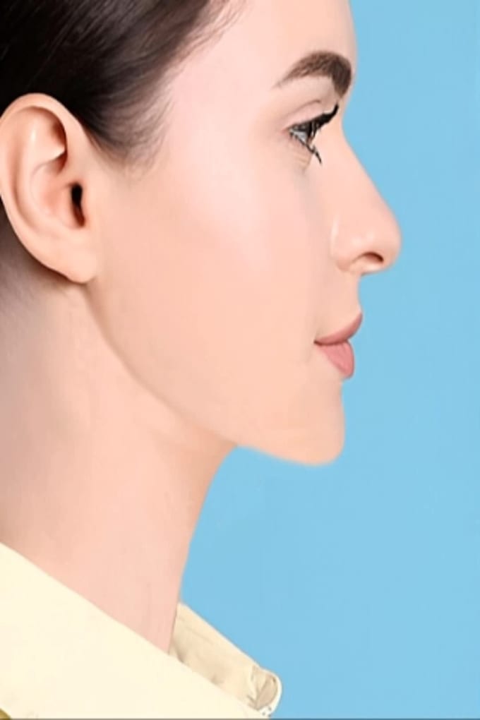 do pro face retouching, face and body slimming in 2 hours