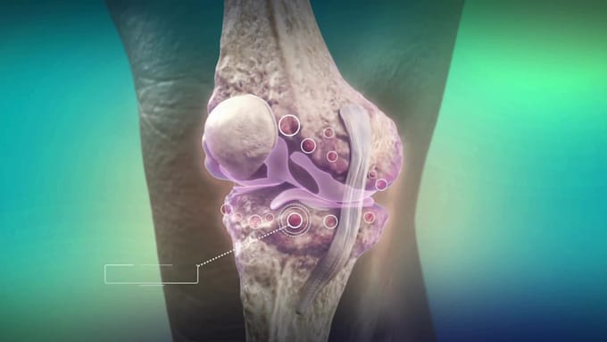 3d medical device explainer, anatomy video and medical animation