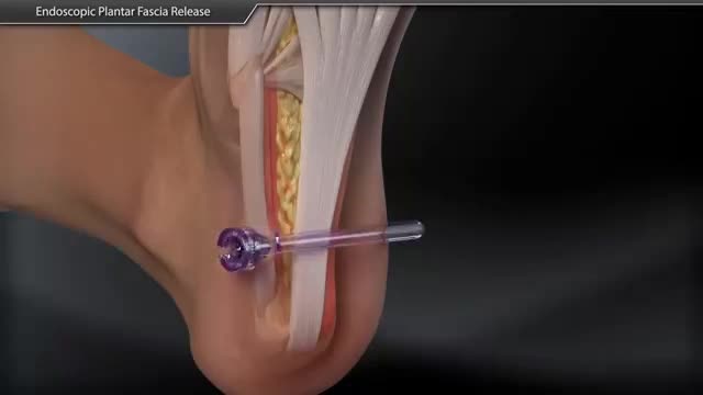 make 3d medical explainer video, 3d surgery animation, and 3d medical video