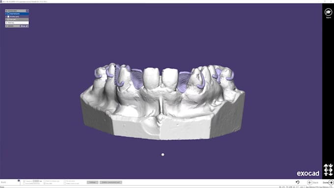 setup exocad 3,2 and partial cad software with guarantee