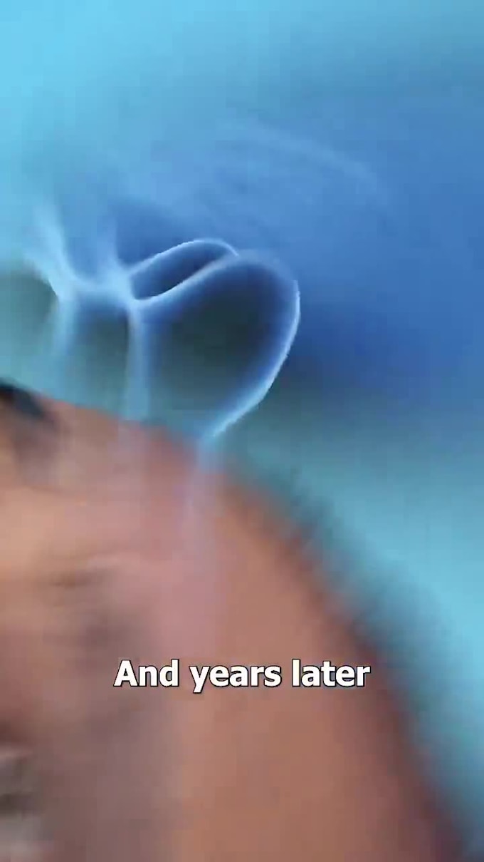 do high quality 3d medical animation video, human anatomy, 3d product animation