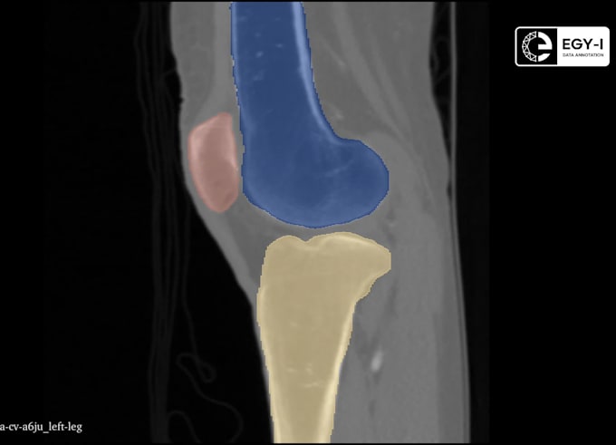 offer medical annotation services for ai model training