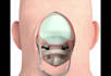 do 3d medical animation surgery animation anatomy biomedical explainer videos