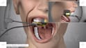 create stunning 3d dental video 3d medical animation for devices and  procedures
