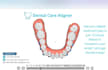 provide expert aligner treatment planning services