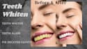 fix, adjust, whiten teeth in photoshop within 24 hours