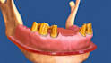 do animation videos for the dental waiting room