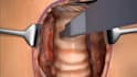 3d medical animation, anatomy explainer, surgery procedure animation, 3d surgeon