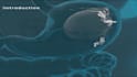 create best 3d medical animation and 3d modeling
