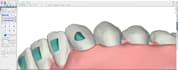 treatment planning service for clear aligners