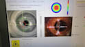 teach you ophthalmology and discuss your eye disorders
