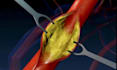 3d vfx medical animation dental animation 3d explainer video surgery animation