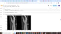 develop machine learning,nlp and deep learning models in python