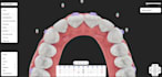 provide dental clear aligners treatment planning services
