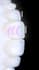 do a professional video editing on your dental cases