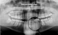 read your dental x rays