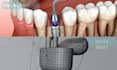create 3d explainer videos for dental tools or tech product demonstration