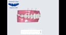 design precise clear aligner treatment plans for your cases