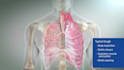 3d medical animation video, 3d dental 3d realistic animation and modeling