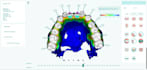 provide dental clear aligners treatment planning services