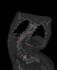 convert ct and mri images to 3d file