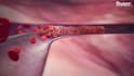 do 3d medical device animation 3d surgical device animation 3d medical explainer