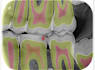 deliver a highly precised annotated dental radiograph