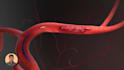 do 3d visualization medical animation