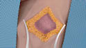 do surgery 3d animation