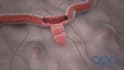 make attractive high quality 2d ,3d medical animation video and modeling