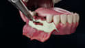 create 3d dental and oral animation for implants braces and procedures