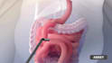 do 3d medical animation healthcare explainer, medical device, dna anatomy video