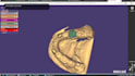 create professional dental cad designs using exocad