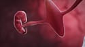 create 2d or 3d cgi animations , device surgery animation anatomy video
