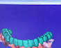 redesign your smile beautiful