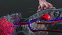 do 3d medical device animation 3d medical explainer 3d surgical device animation