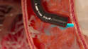 do 3d medical animation anatomy visualization biotech and pharma moa explainer