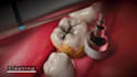 create realistic dental animation and 3d medical visualization