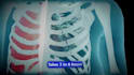 create realistic 3d surgical procedure animation for medical education training