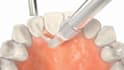do 3d dental animation, 3d dentistry process, 3d medical animation