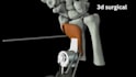 create 3d medical animation, surgical animation, surgery animation video