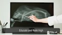 write patient education articles ,website content and infographics